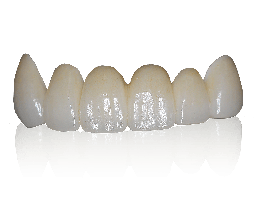 Full-Zirconia (1)