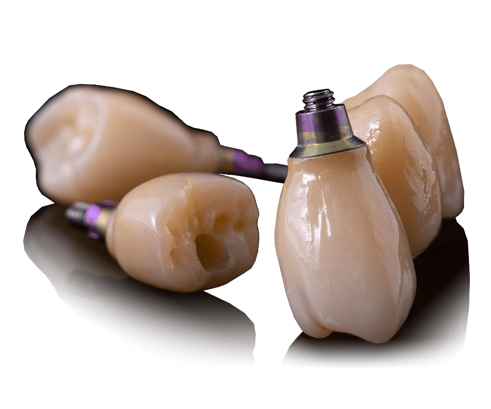 Screw-Retain-Crown-&-Bridge-2
