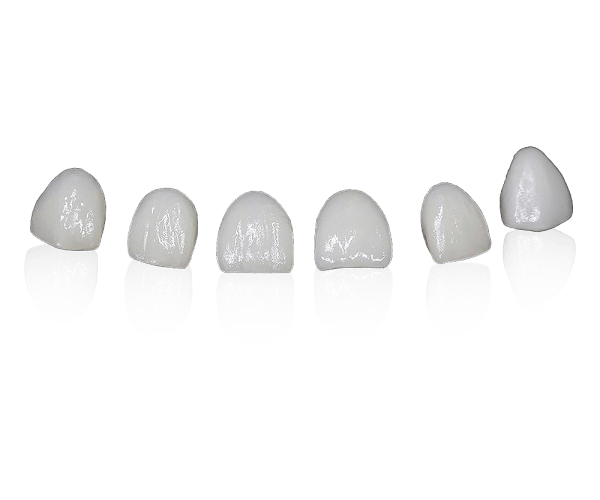 Veneers-2 (1)